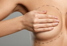 Breast Asymmetry Correction Breast Asymmetry Correction