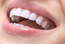 Laminated Teeth Dentist Didim, Dental Clinics Didim Turkey