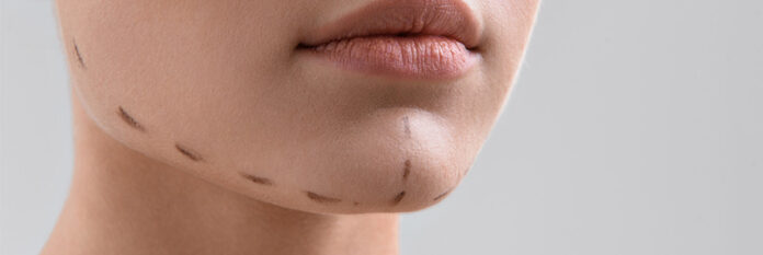 cene-estetigi-1 Things to Do After Face Lift Surgery