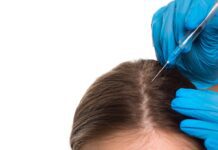 Scalp Micropigmentation Bodrum Scalp Micropigmentation Bodrum