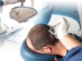Robotic Hair Transplant in Turkey
