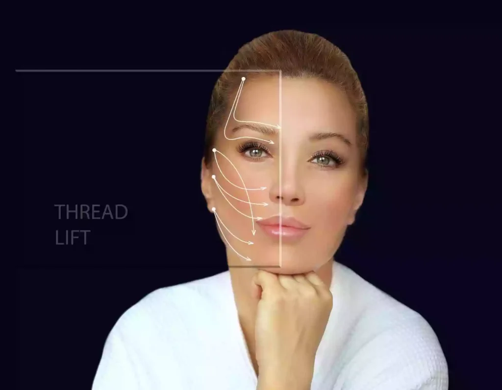 Face Straps Thread Face Lift Bodrum