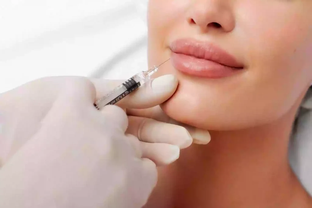 Lip Filler Bodrum