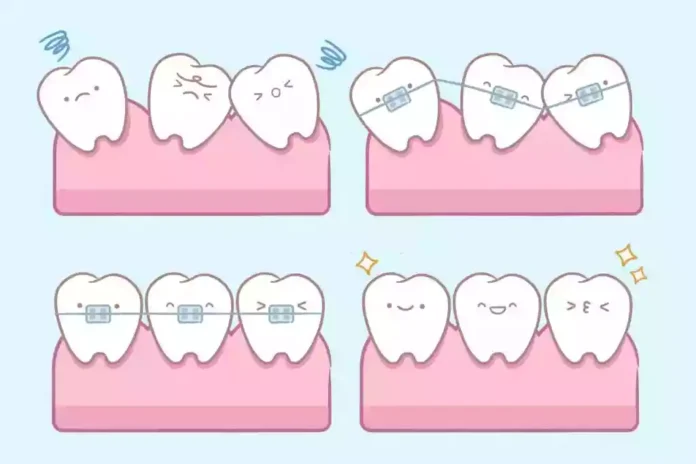 Orthodontics