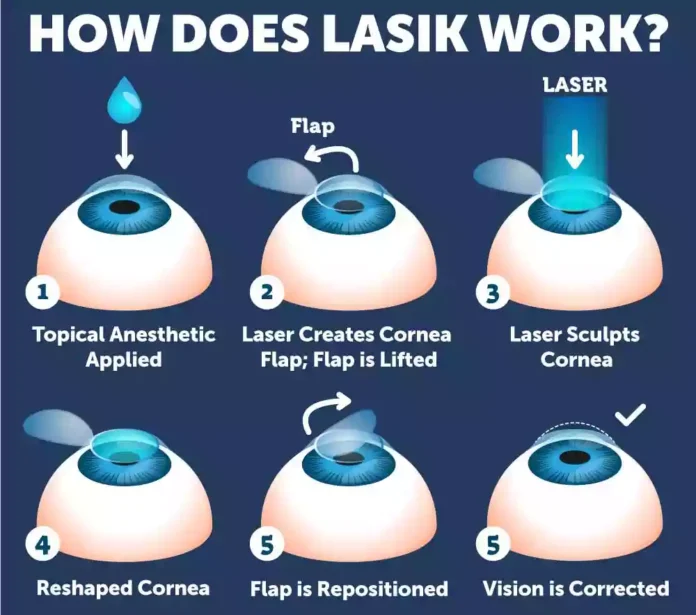Lasik Eye Surgery Bodrum