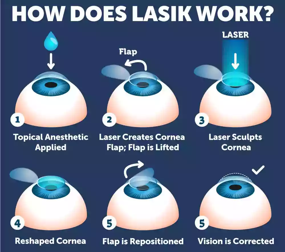 Lasik Eye Surgery Bodrum