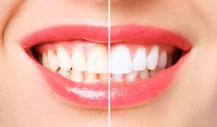 Dentist in Gumbet