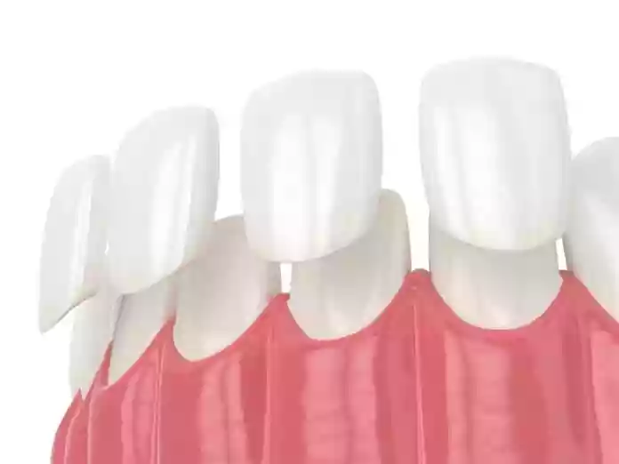 Dentist Bodrum, Dentist in Bodrum