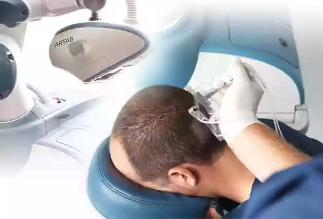 Hair Transplant Marmaris Turkey
