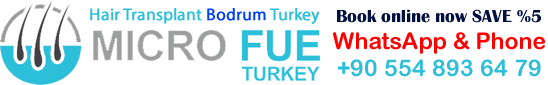 Hair Transplant Bodrum Turkey Book online now SAVE %5 WhatsApp & Phone : +90 554 893 64 79 For free online consultation please send your photos through WhatsApp