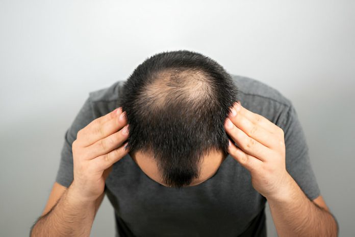 Saç Ekimi Bodrum Saç Ekimi Bodrum