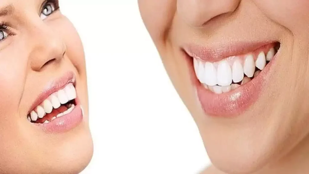 Implants Bodrum, Dental Implant Bodrum